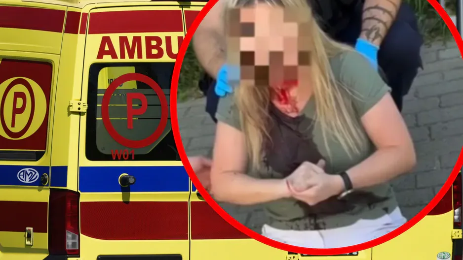 У польській Ґдині невідомий вдарив українку тростиною по голові, нападника розшукує поліція – ЗМІ
